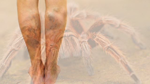 spider with red legs